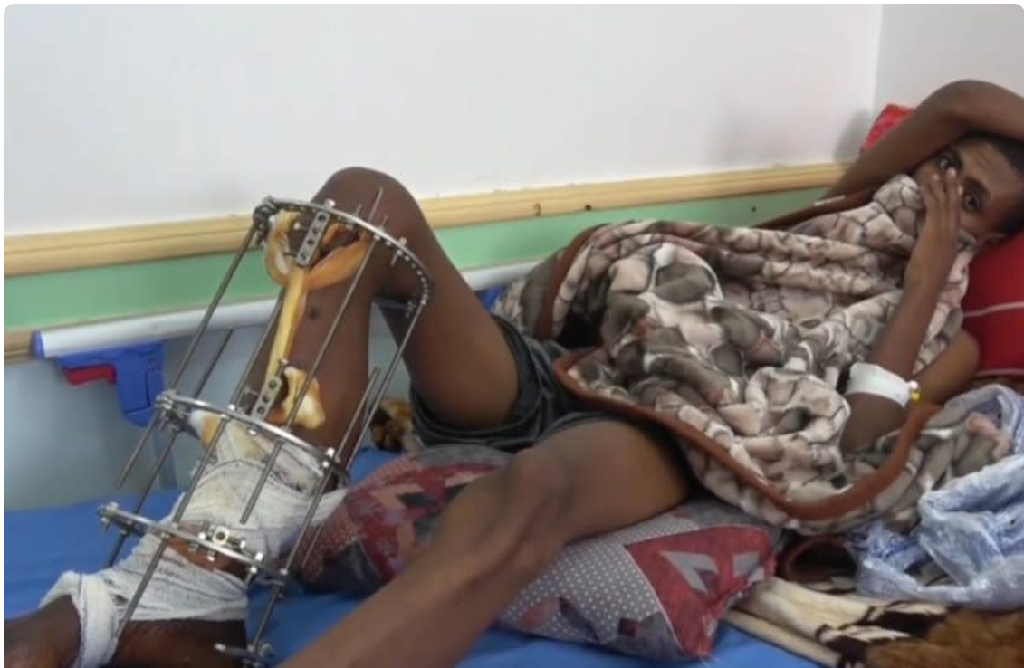 Tragedy at the Border: Hundreds of Migrants Killed by Saudi Border Guards - A Disturbing Report