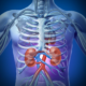 The Signs that shows Your Kidney Is Failing